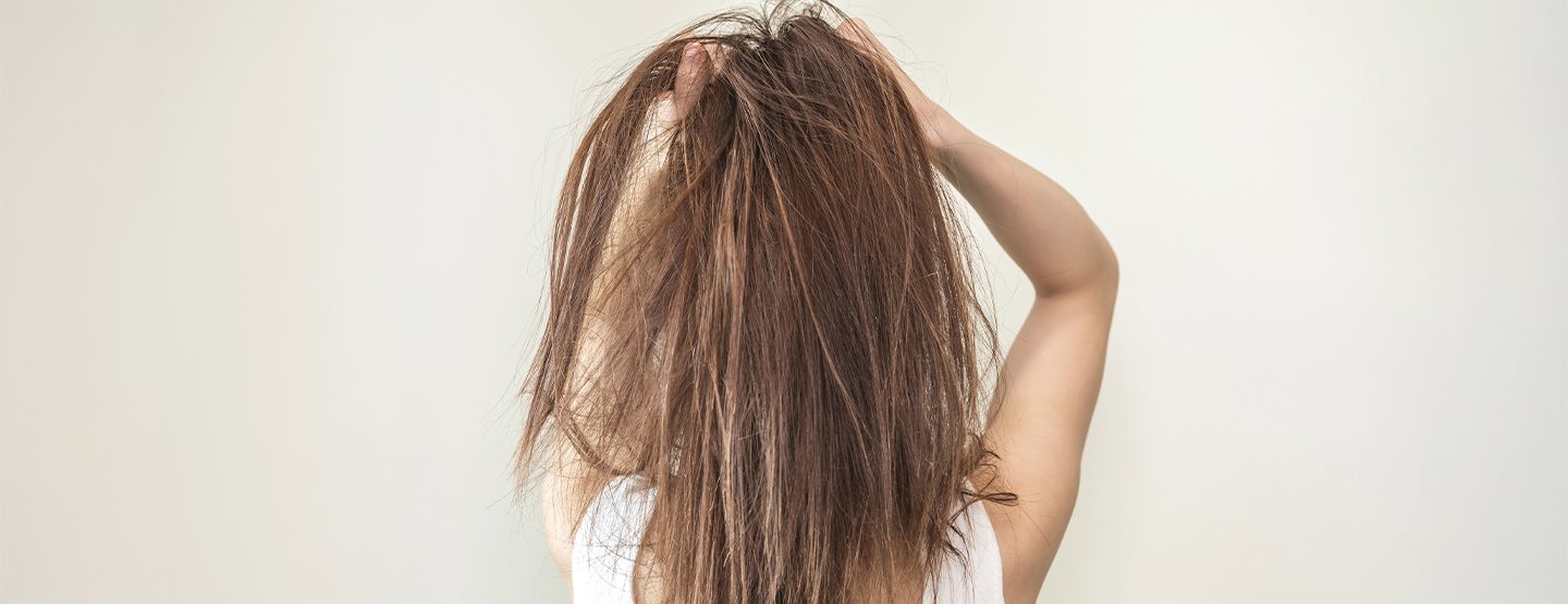 Nie mehr fettige Haare: 5 Tipps helfen