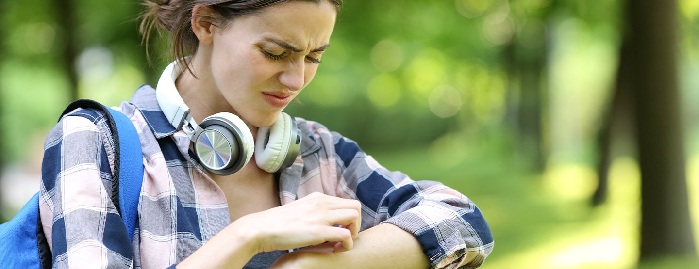 Mückenstich: 5 Hausmittel, die helfen!