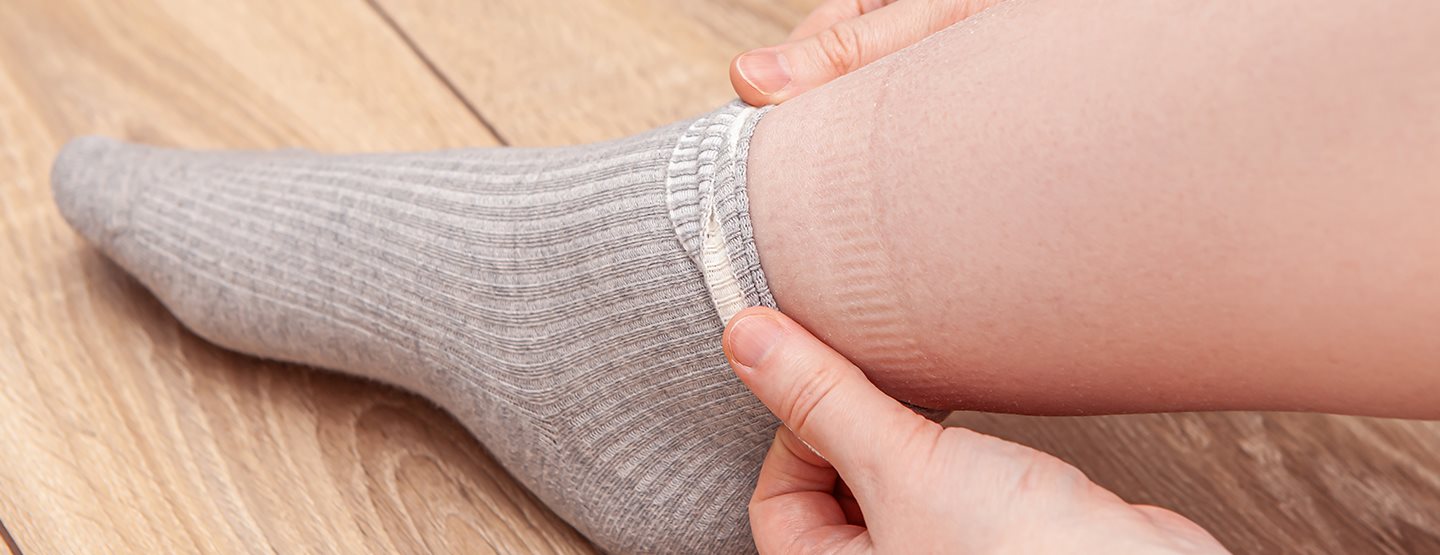 Wassereinlagerungen loswerden: 7 Tipps