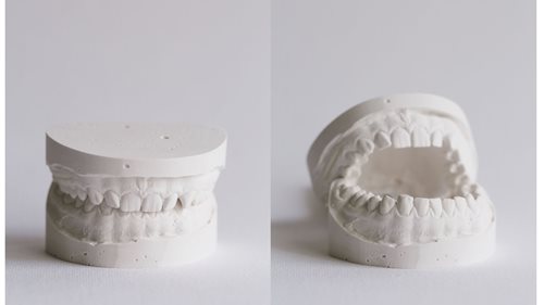 Zahnpflege-Mythen: Sind weiße Zähne erblich?