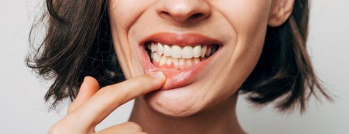 Zahnfleischbluten: An diesen Ursachen liegt es laut Zahnärztin