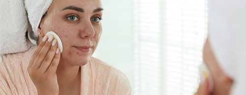 Akne tarda: Das hilft bei Erwachsenenakne!