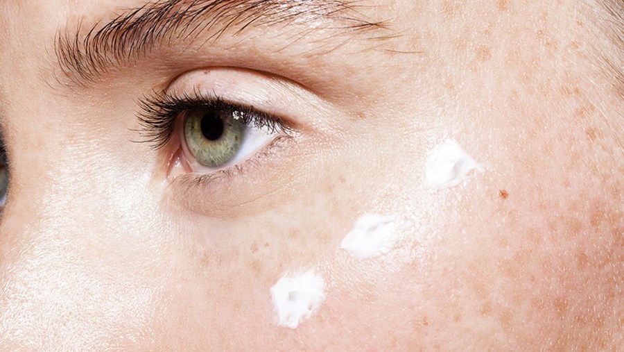 Rosacea Creme: Die richtige Pflege